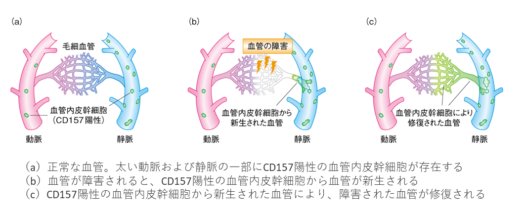 CD157養成の血管内皮幹細胞による血管の修復 | 再生医療.net